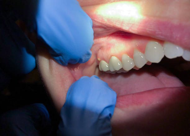 Best After-Hours Emergency Dentist in Woodstock, IL
